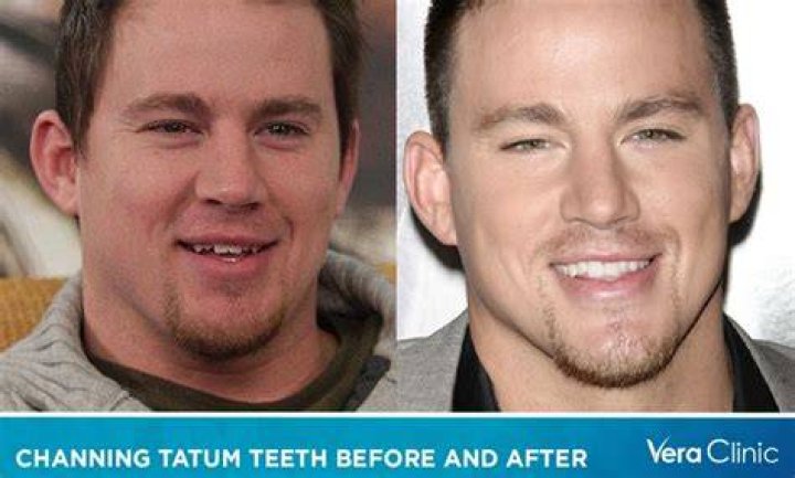 Unveiling Channing Tatum's Dance Legacy: Insights And Discoveries